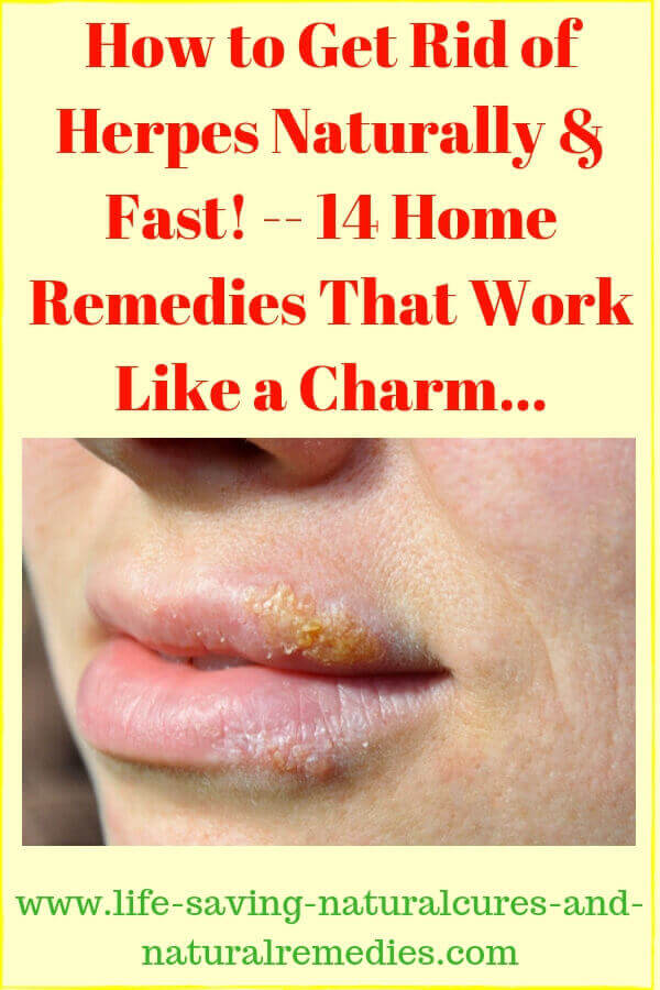 To rid ways herpes get natural of 15 Home
