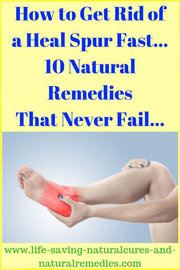 Natural remedies for bone spurs
