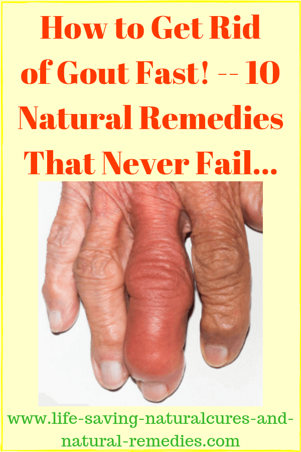 Home Remedies for Gout Best
