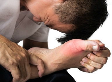 Best Gout and Gouty Arthritis Remedies